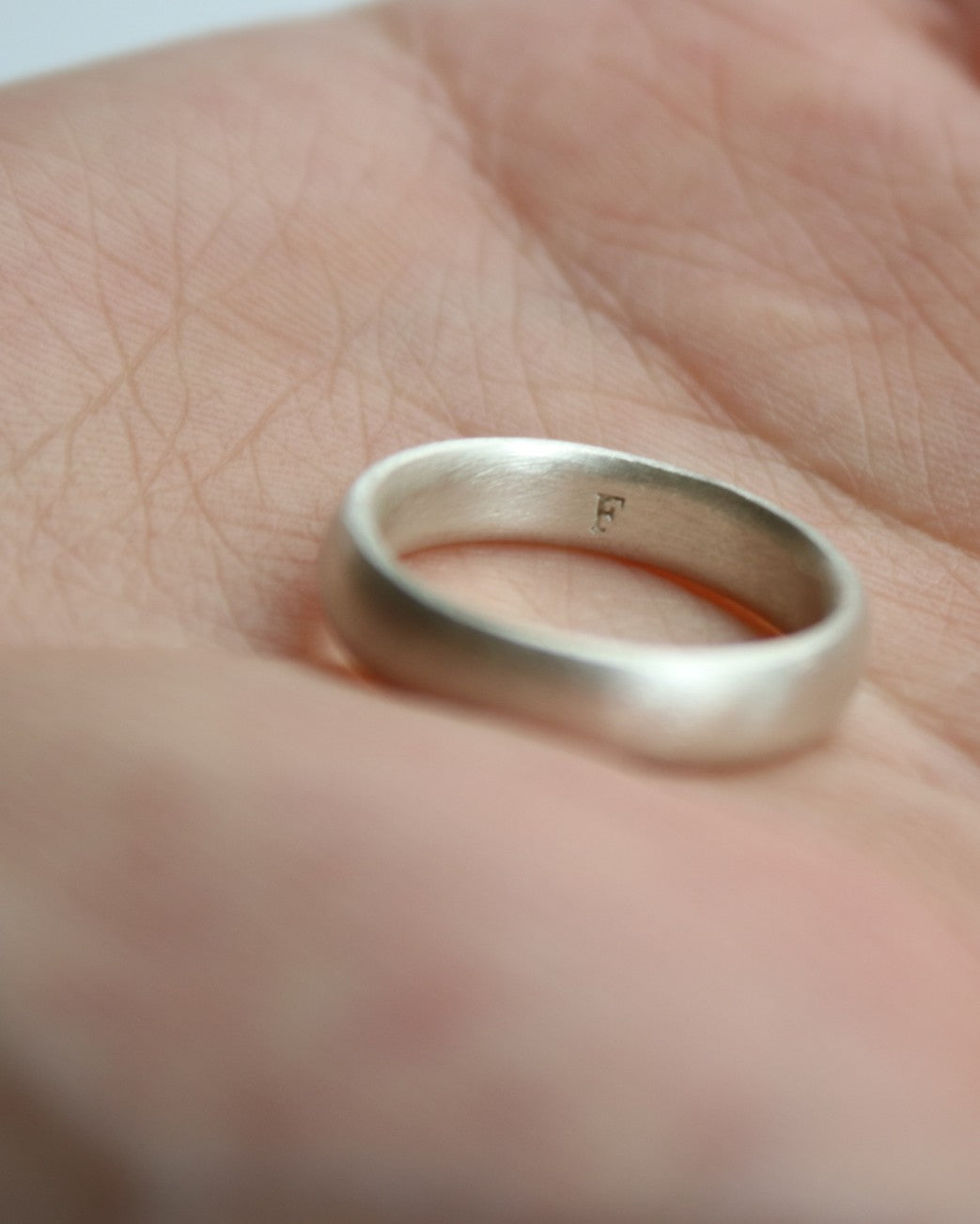 [amondz exclusive] Dome